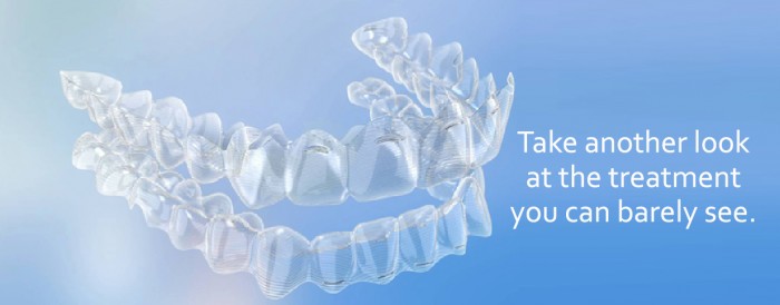 Invisalign braces frame