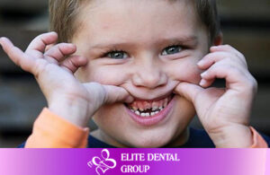 Filling grooves to prevent tooth decay for children