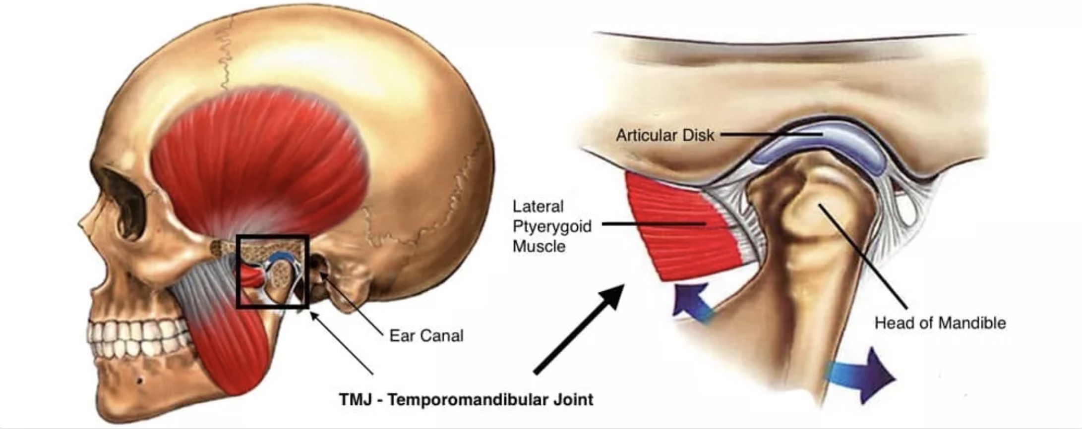 tmj-disorder