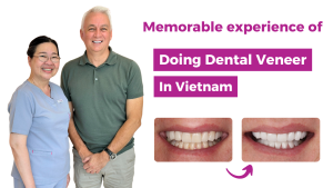 Memorable experience of doing dental veneer in Vietnam