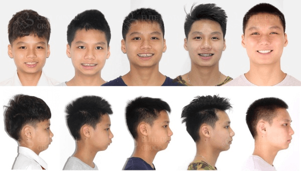 the orthodontic journey