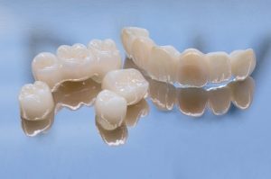 all porcelain crowns cost