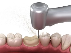 tooth pain with a crown