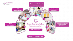 wisdom tooth cost removal