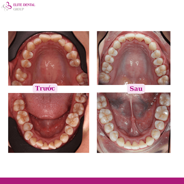 ms-thu-cuc-treatment-result