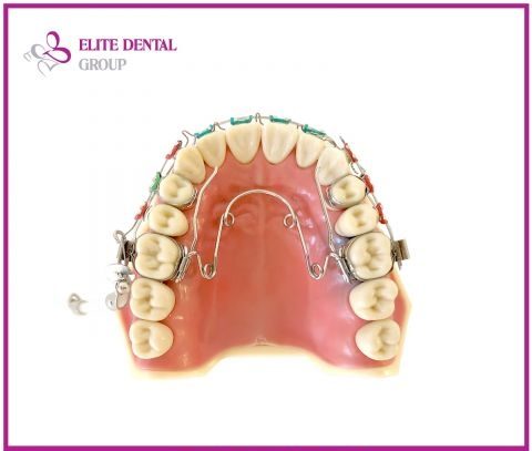 orthodontic devices