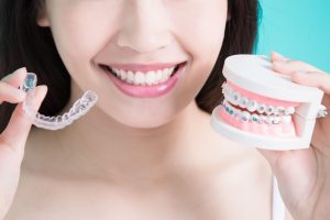 methods to straighten teeth fast