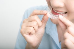 Are clear aligners effective for braces?