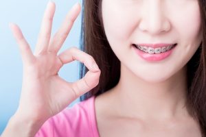 The duration of braces treatment