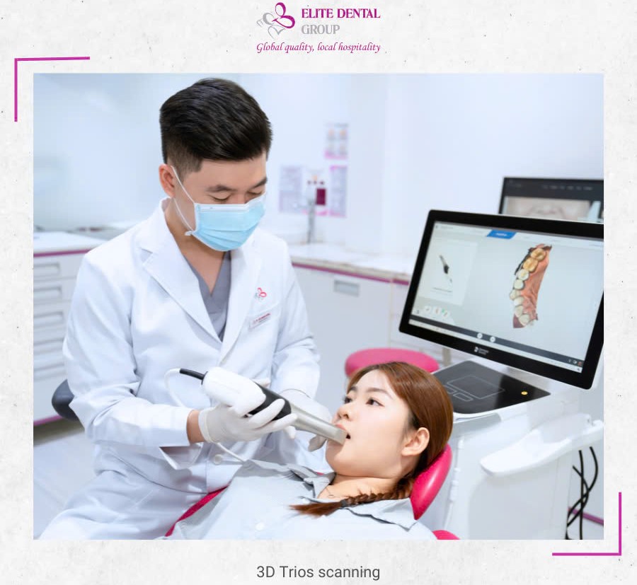 3D Trios Scanning