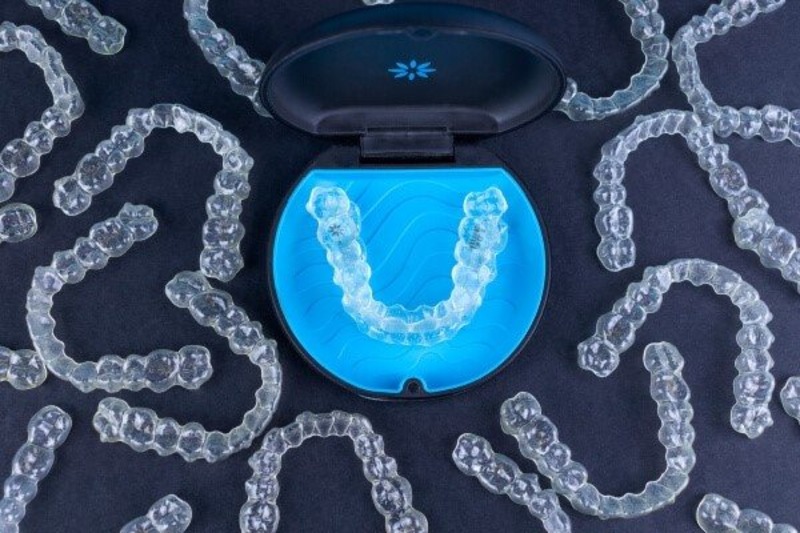 What are clear braces