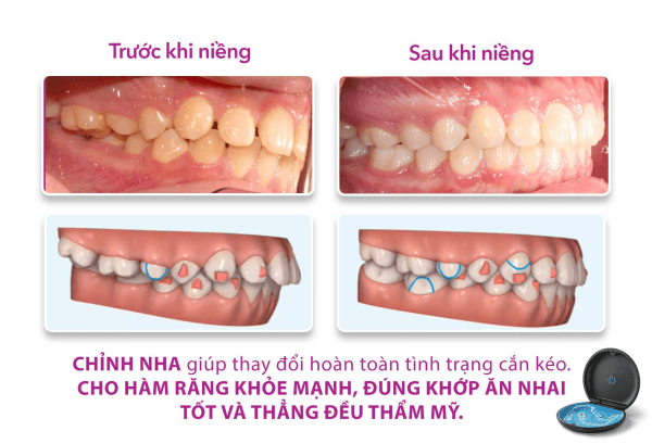 case asymmetrical jaw