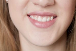 A simple way to know which side of your face is asymmetrical is to smile while looking in the mirror. The side your lips pull towards more is the asymmetrical side.