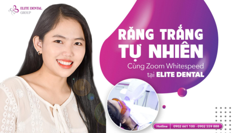 How much does teeth whitening cost?