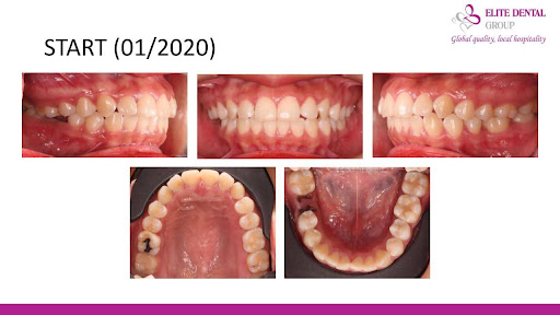 Ảnh chụp tổng quan trước khi khám