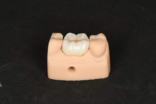 Chiếc răng sứ được chế tác tinh xảo tại Elite Dental