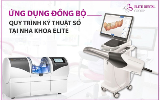 Công nghệ scan lấy dấu răng 3D