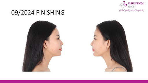 Kết quả đạt được sau khi kết thúc quá trình điều trị