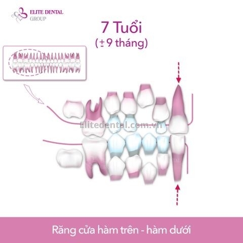 quy trình thay răng của trẻ em từ 6 - 12 tuổi 2