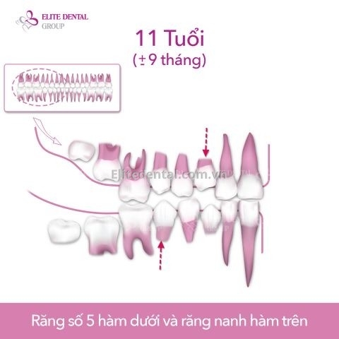 quy trình thay răng của trẻ em từ 6 - 12 tuổi 6