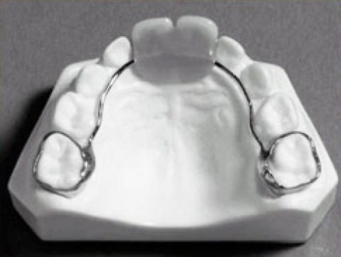tai nạn trong giai đoạn thay răng của trẻ 1
