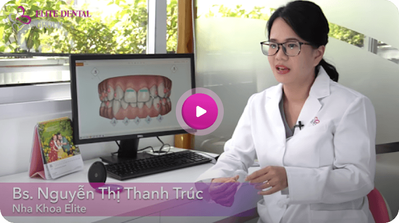 Cùng BS. Thanh Trúc tìm hiểu rõ hơn về phương pháp niềng răng trong suốt Invisalign