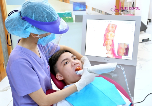 Công nghệ scan răng 3D Trios tại Elite Dental