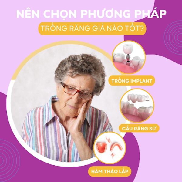 Giá trồng răng