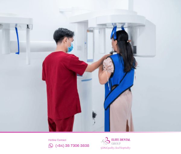 Hình ảnh khách hàng chụp phim X-quang tại Elite Dental để bác sĩ nhìn rõ tình trạng răng, xương hàm.