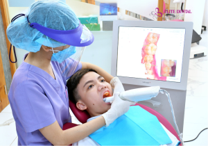 Khách hàng chụp hình scan 3D răng trước và sau khi niềng răng