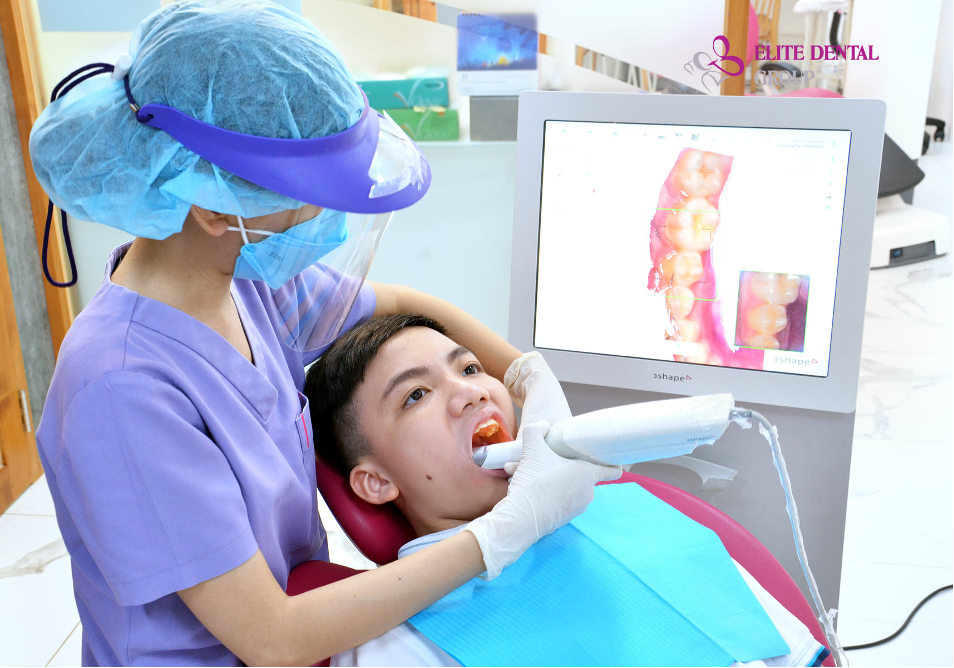 Khách hàng chụp hình scan 3D răng trước và sau khi niềng răng