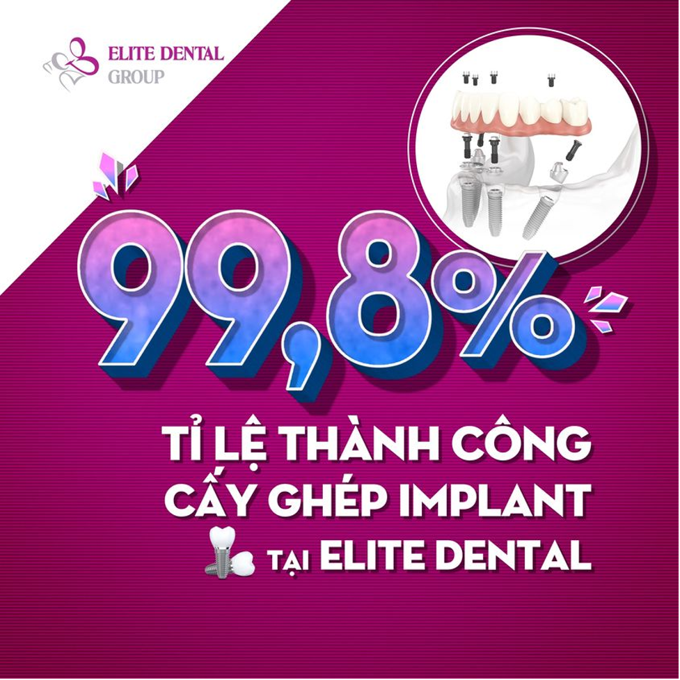 Tỷ lệ thành công khi trồng răng implant tại Elite Dental đạt 99,8%