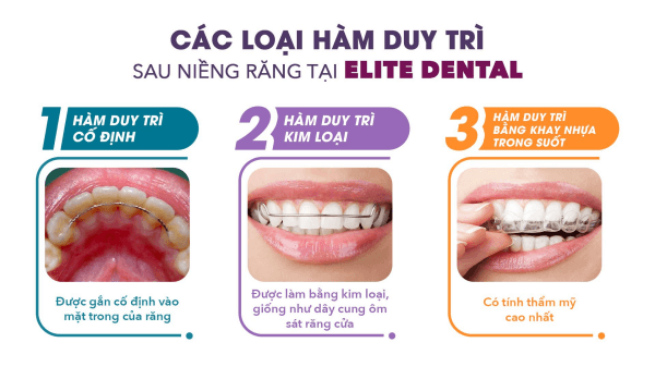 Các loại hàm duy trì tại Elite Dental