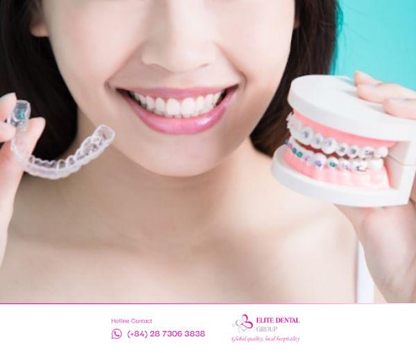 Nên chọn trả góp niềng răng tại các nha khoa uy tín để có trải nghiệm an toàn, thoải mái và đạt hiệu quả lâu dài.