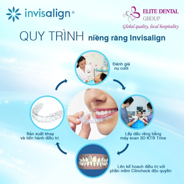 Quy trình niềng răng Invisalign tại Elite Dental