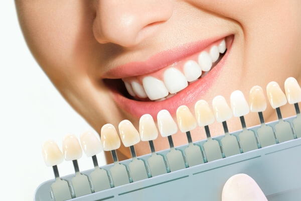 Làm răng sứ đẹp và 4 điều bạn nhất định phải biết