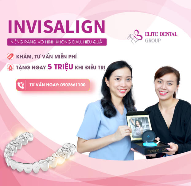 Niềng răng trong suốt Invisalign và 8 điều nhất định phải biết