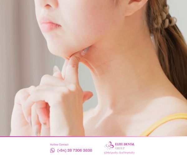 Cằm lẹm là tình trạng cằm không đạt độ nhô chuẩn