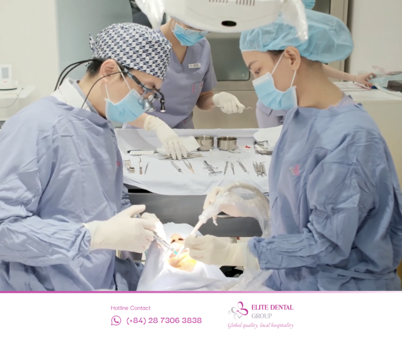 Cấy Implant tức thì ngay sau nhổ răng giúp rút ngắn thời gian và hạn chế tiêu xương hàm