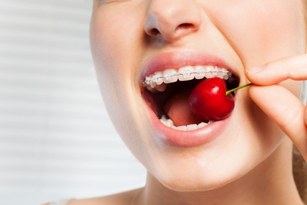 Trái cây tươi là thực phẩm lý tưởng cho người niềng răng
