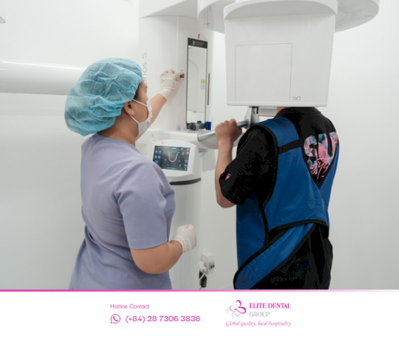 Bệnh nhân cần được chụp phim CT trước khi trồng răng Implant