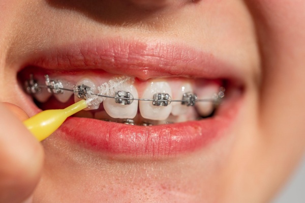 Vệ sinh răng miệng đúng cách và thường xuyên