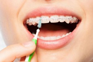 Bàn chải kẽ giúp tăng hiệu quả sạch răng