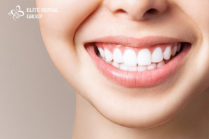 Bọc răng sứ đúng quy trình mang lại kết quả hoàn hảo cho khách hàng