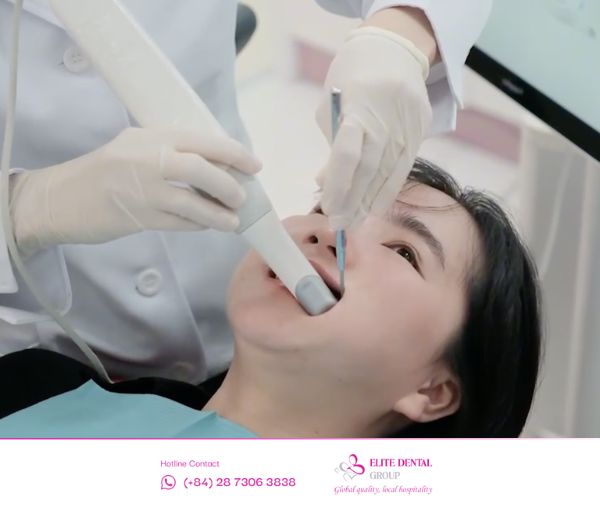 Trước tiên bạn cần chọn đơn vị nha khoa uy tín để thăm khám