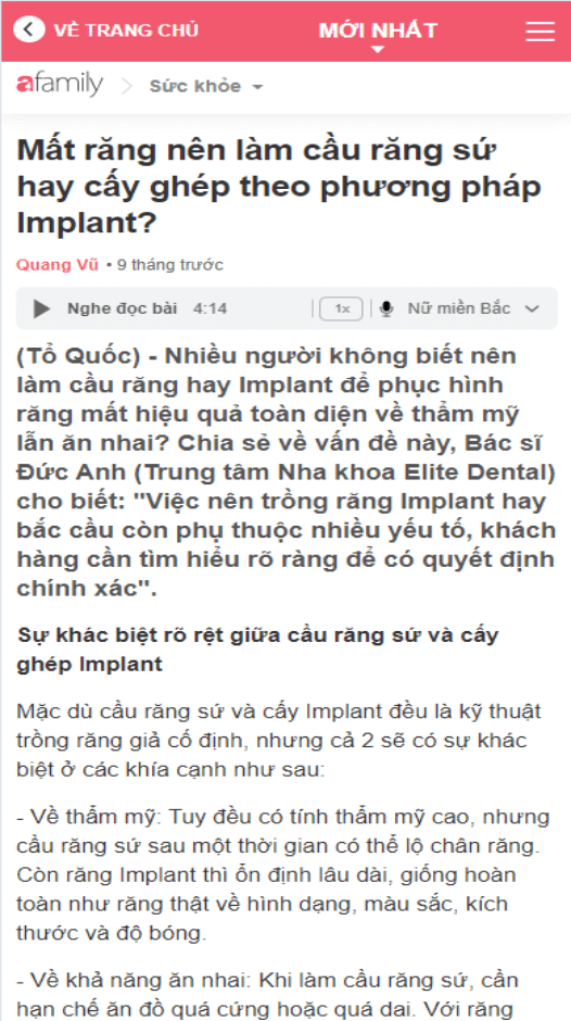 Afamily - Mất răng nên làm cầu răng sứ hay cấy ghép Implant