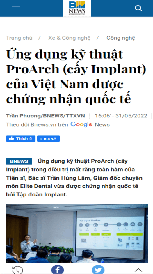 Bnews - Ứng dụng kỹ thuật Proarch cấy Implant của Việt Nam được chứng nhận quốc tế