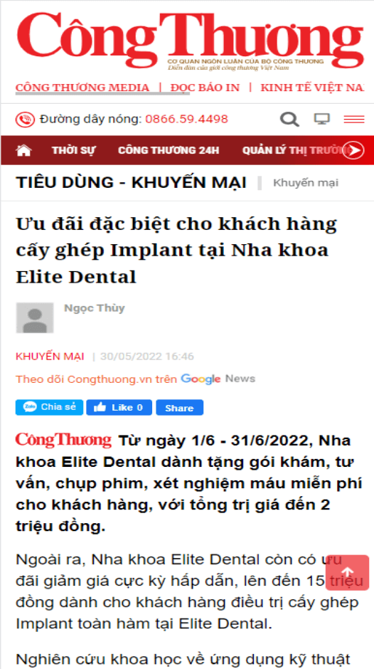 Công Thương - Ưu đãi đặc biệt dành cho khách hàng cấy ghép Implant tại nha khoa Elite Dental