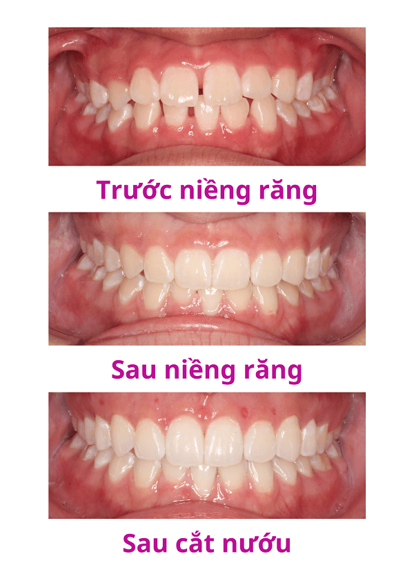 Câu chuyện khách hàng Trần Lê Khanh