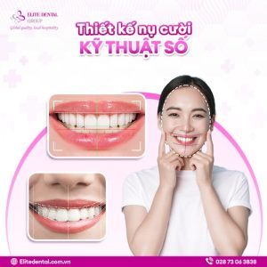 các loại khớp cắn